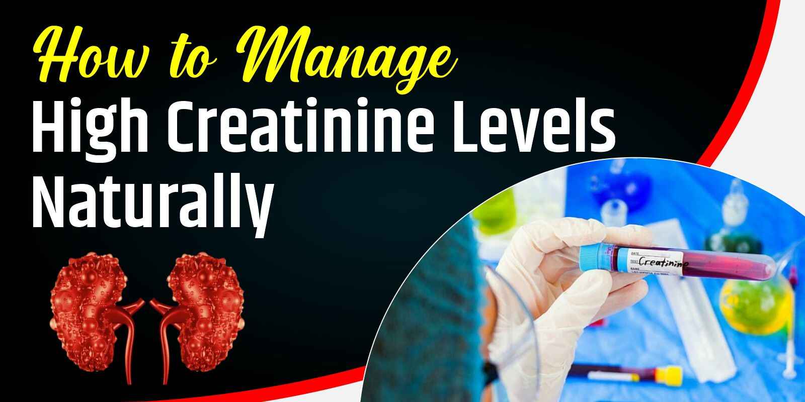 How to Manage High Creatinine Levels Naturally